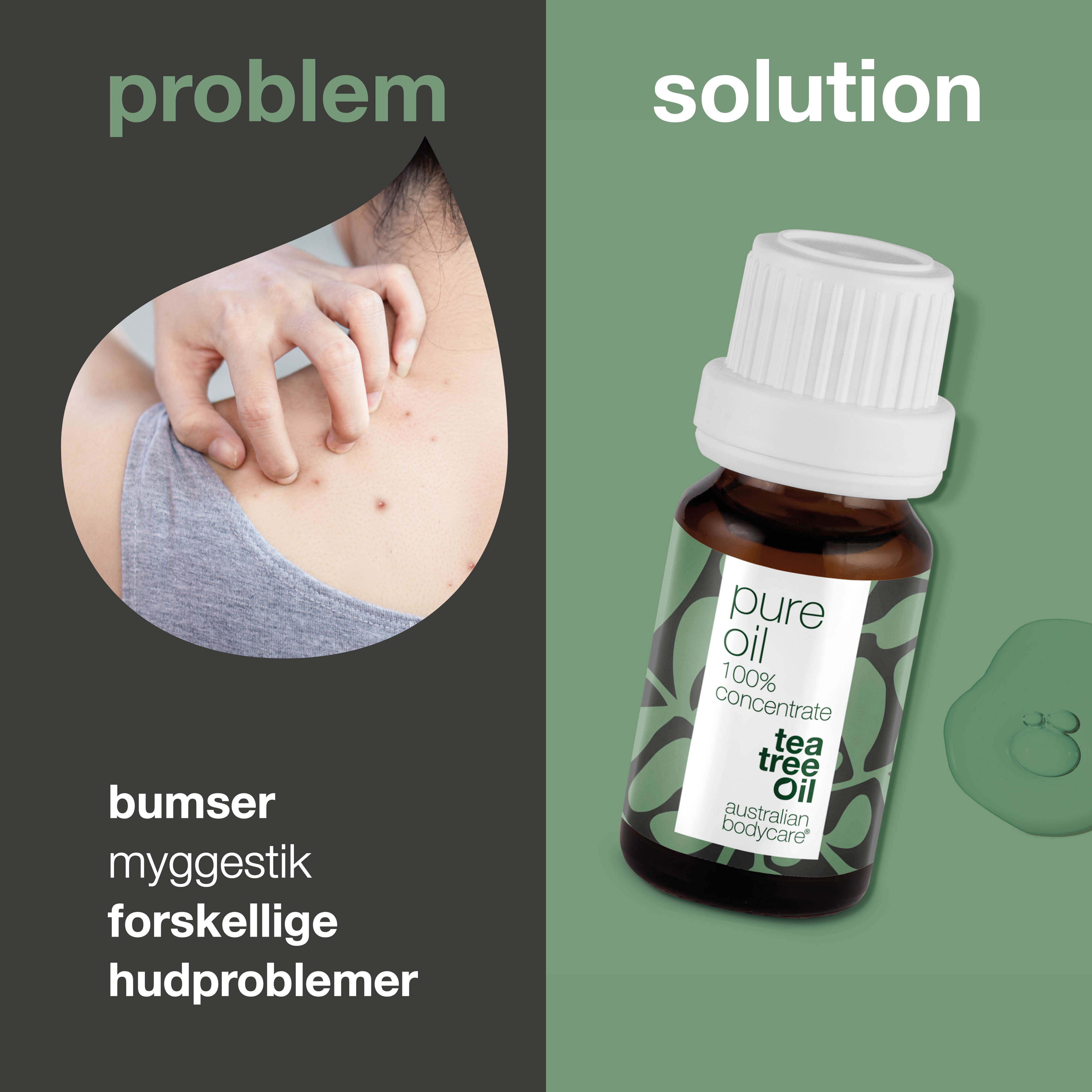 Koncentreret Tea Tree Oil til hudproblemer — 100% naturlig og ufortyndet Tea Tree Oil fra Australien