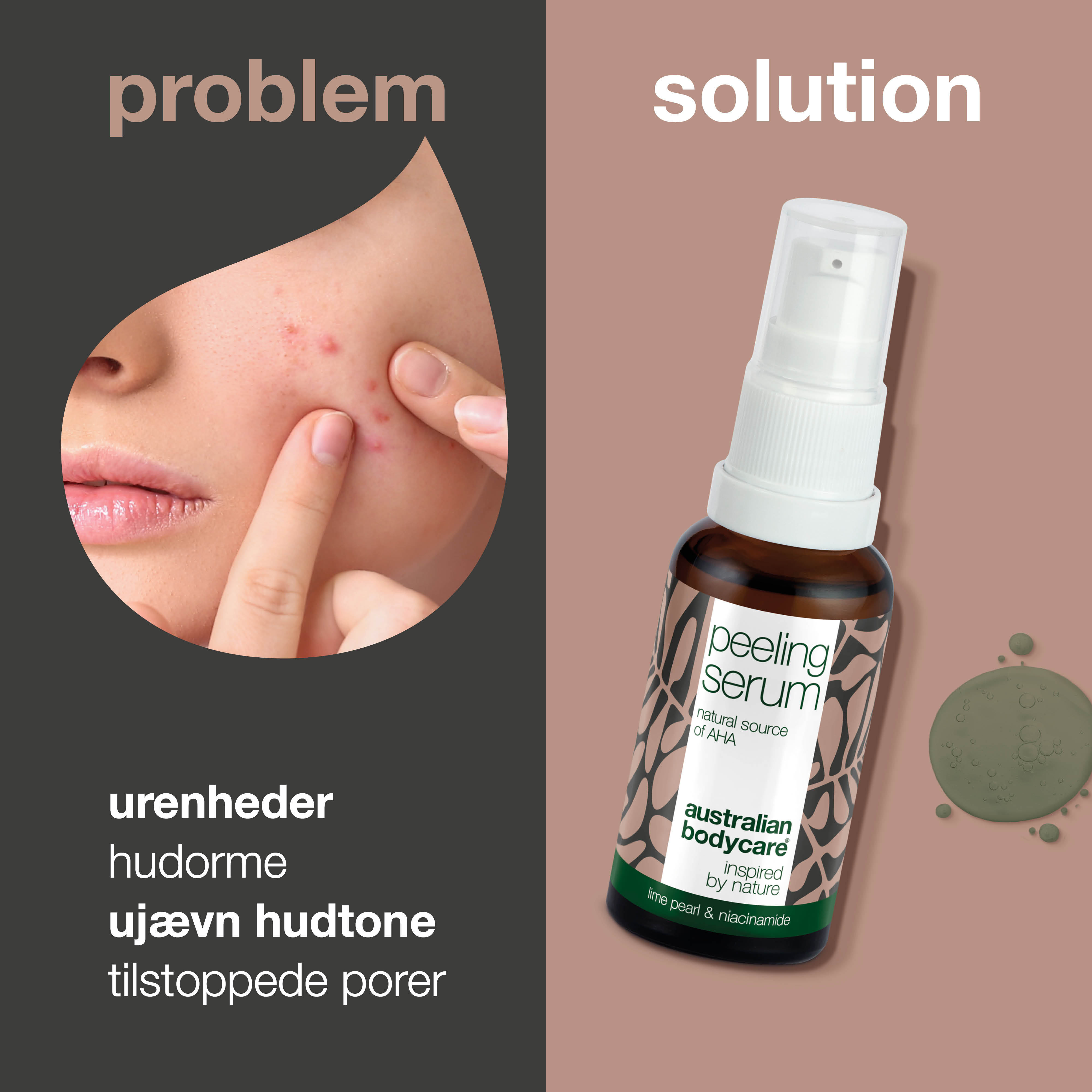 AHA Peeling Serum – Eksfoliering for glattere og friskere hud — AHA Peeling Serum fjerner døde hudceller, udjævner hudens tekstur og giver en sund glød. Med Lime Pearl, Niacinamid og Allantoin.
