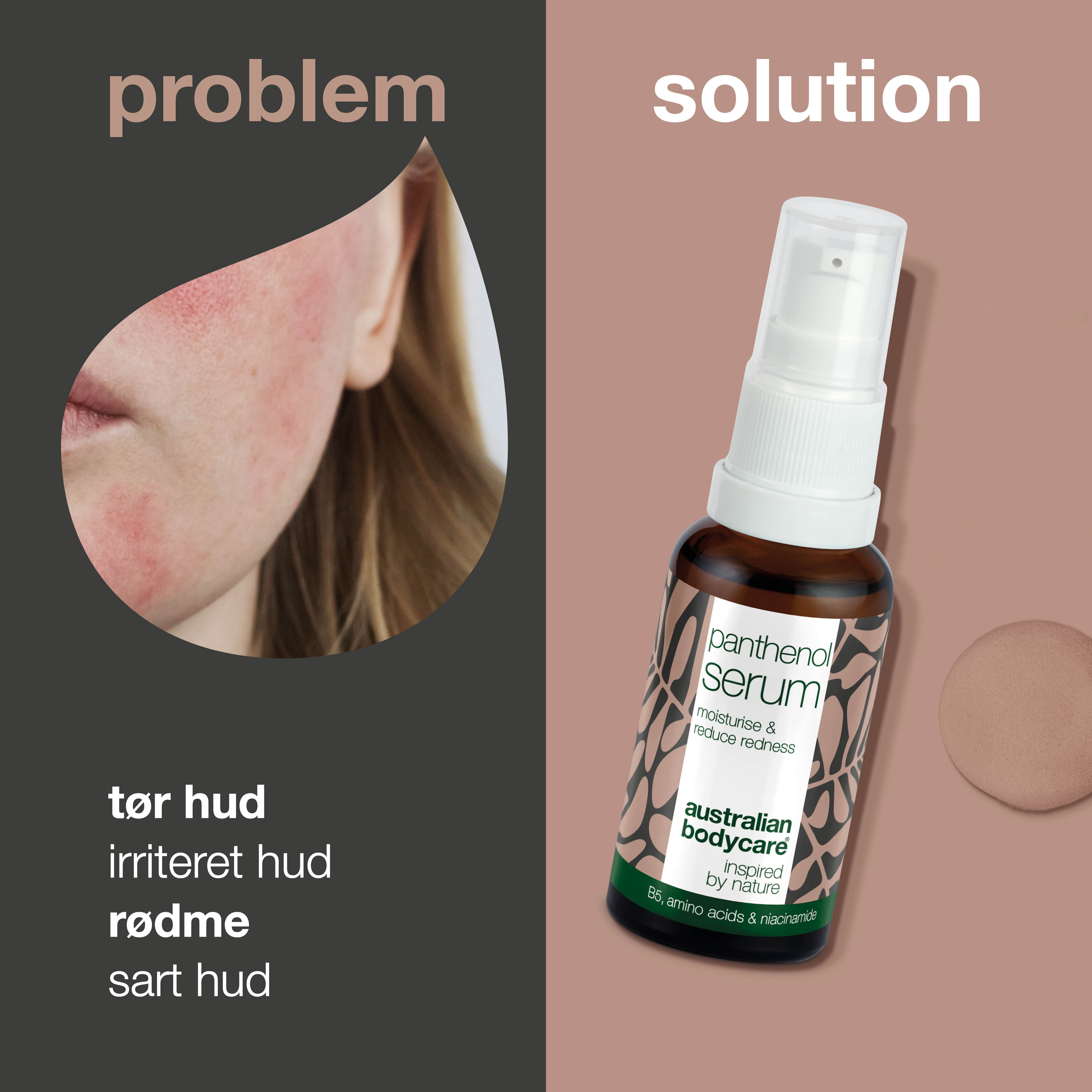 Panthenol Serum – Pleje mod rødme, rosacea & tør hud — Panthenol Serum fugter og beroliger rødme, rosacea & tør hud. Styrker hudbarrieren og reducerer irritation. Perfekt til sensitiv hud.