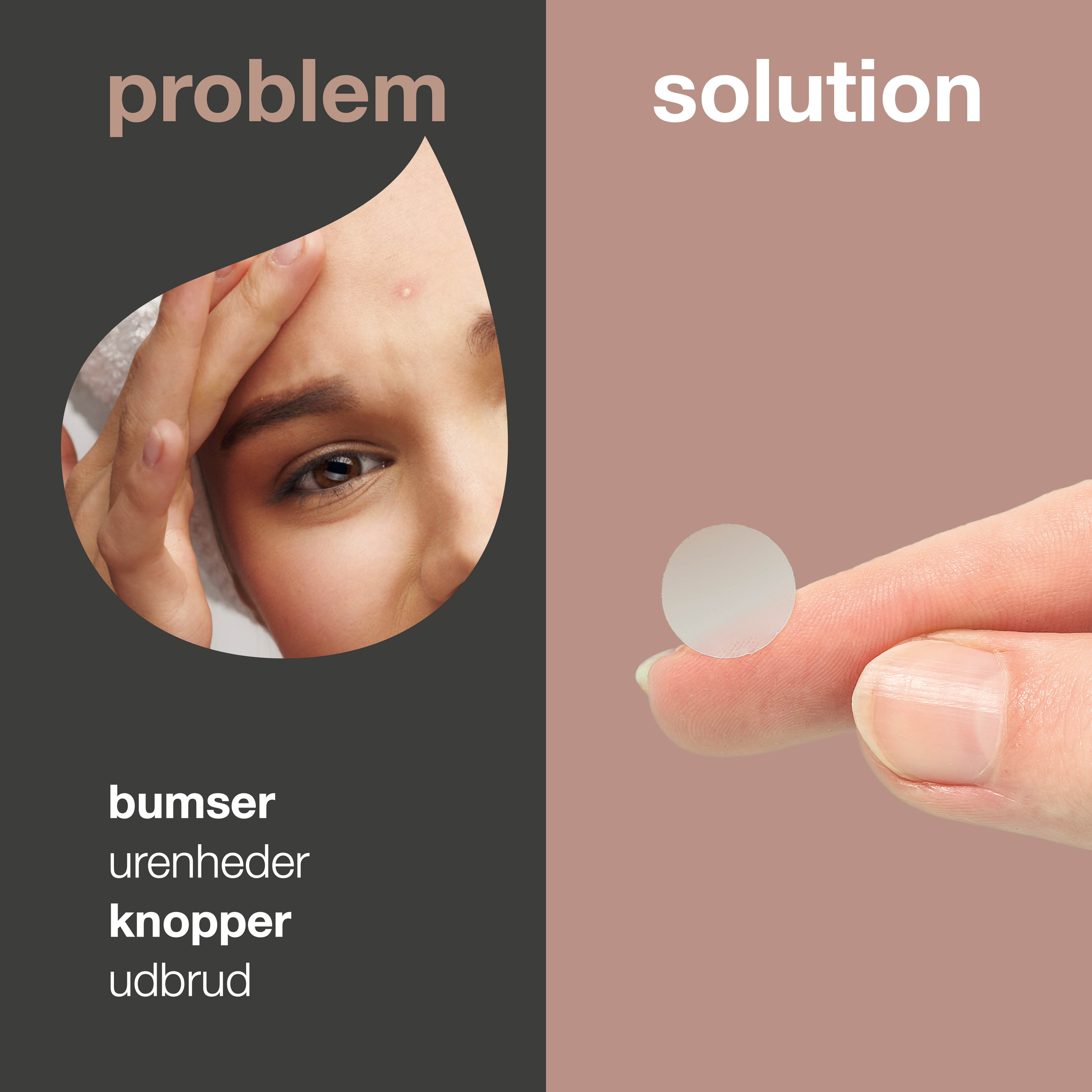 Pimple Patches mod bumser — Effektive Bumse Plastrer med hyaluronsyre & salicylsyre
