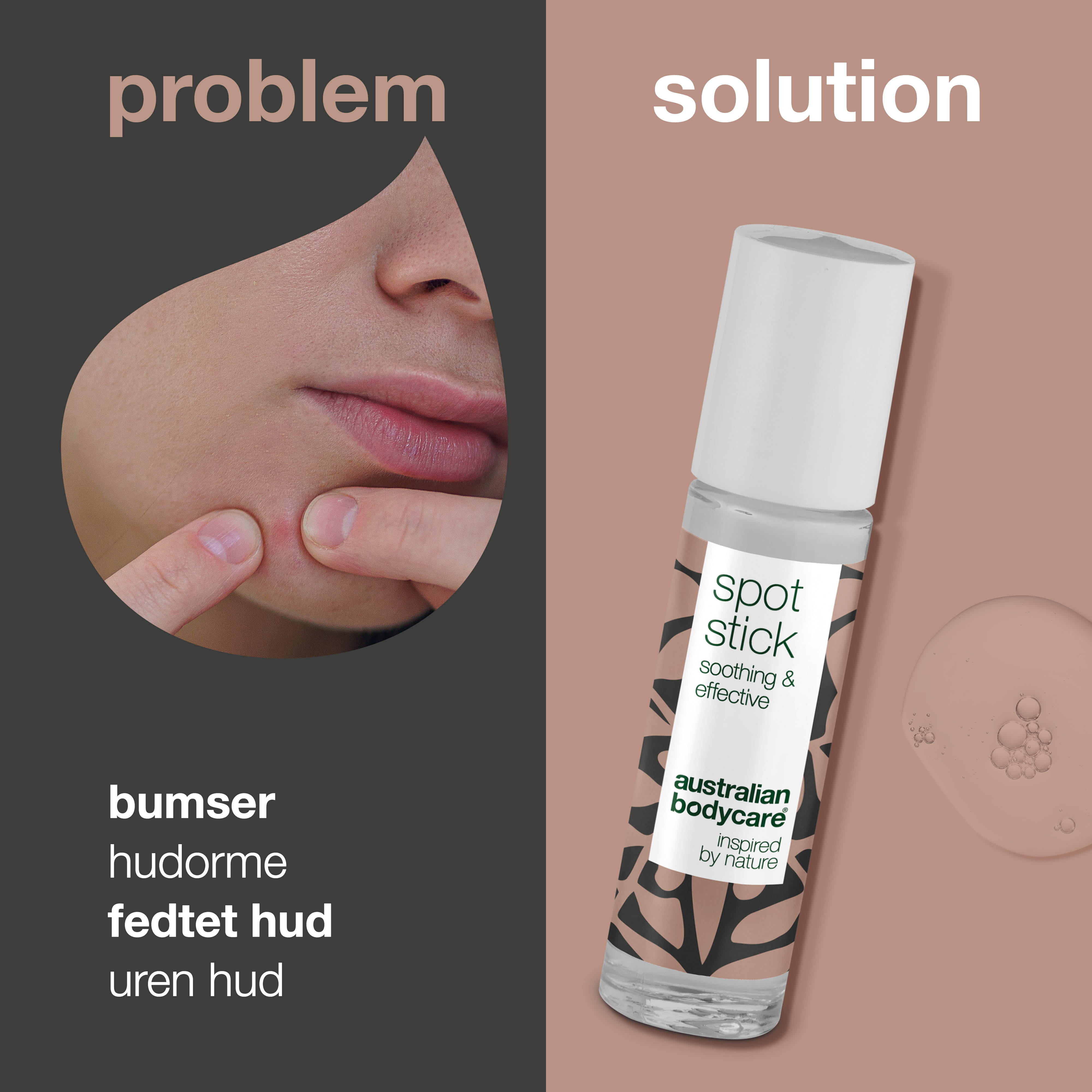 Spot Stick til bumser og uren hud — Effektiv mod bumser, uren hud og hudorme