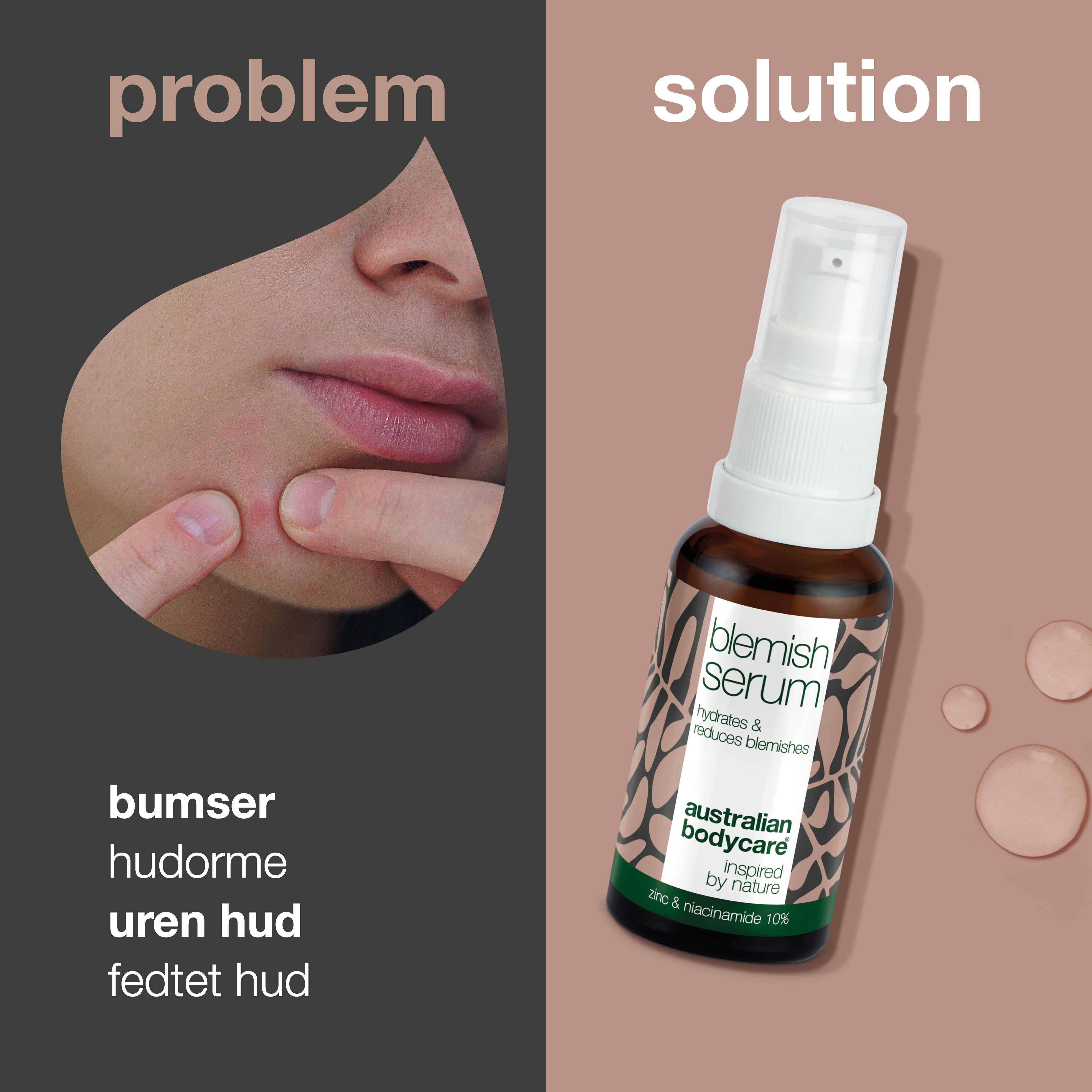 Niacinamide Serum – Mindsker rødme, urenheder og fedtet hud — Niacinamide Serum reducerer rødme, fedtet hud og urenheder. Indeholder 10% niacinamid, zink og hyaluronsyre for en sund og jævn hud.