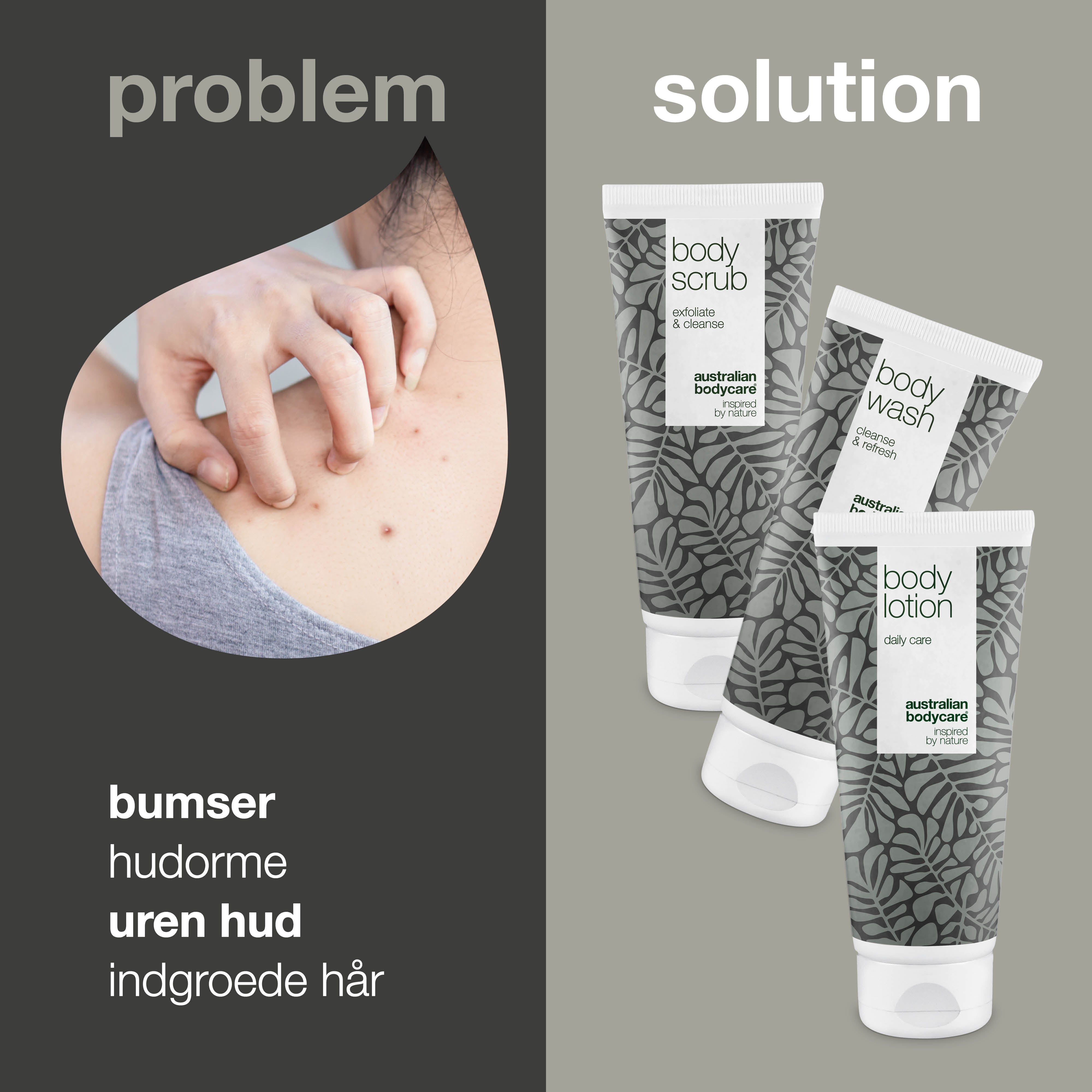Bumser, uren hud på ryggen eller ballerne — 3 produkter med naturlig Tea Tree Oil