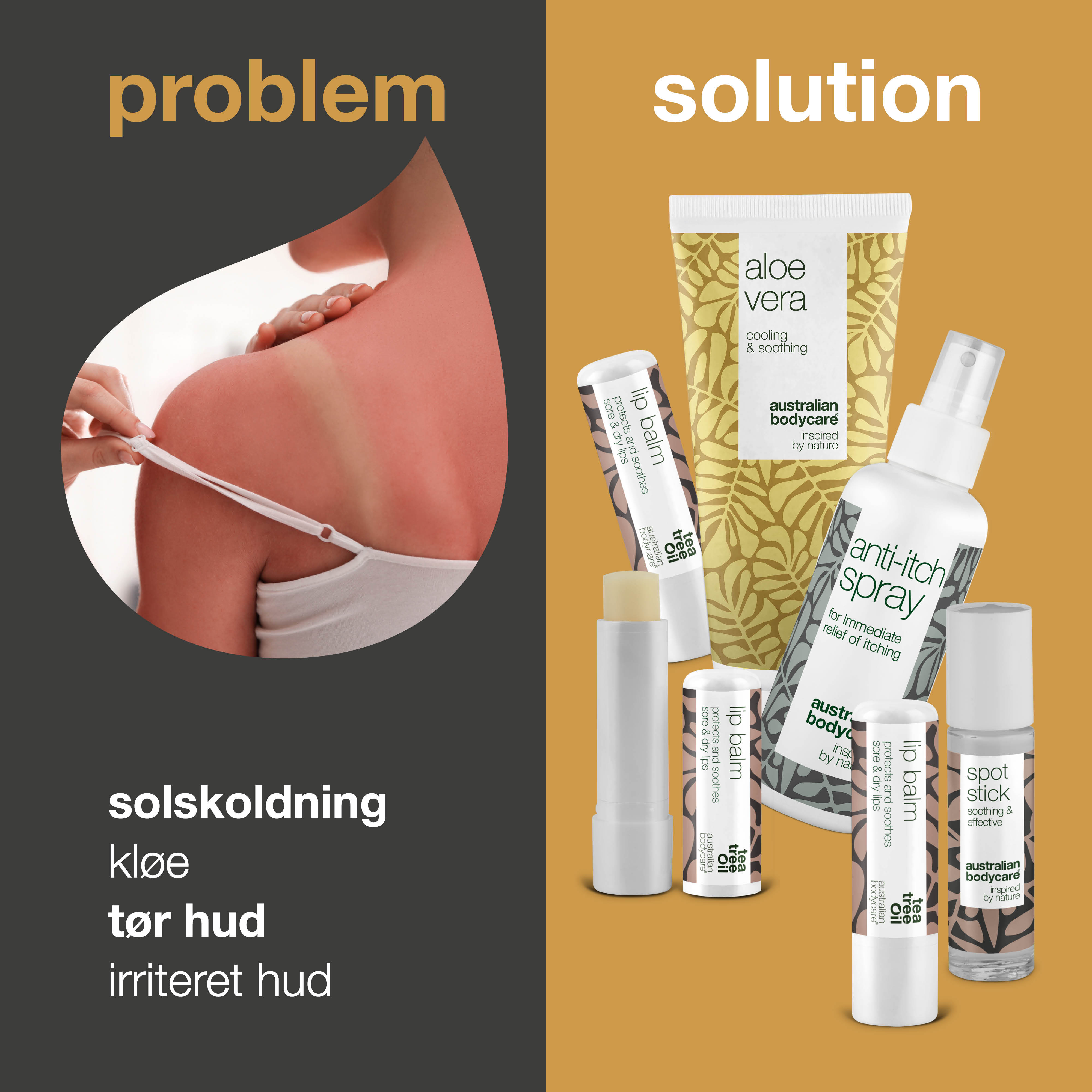 Sommerpakke — Produkter til pleje ved solskoldning eller insektbid