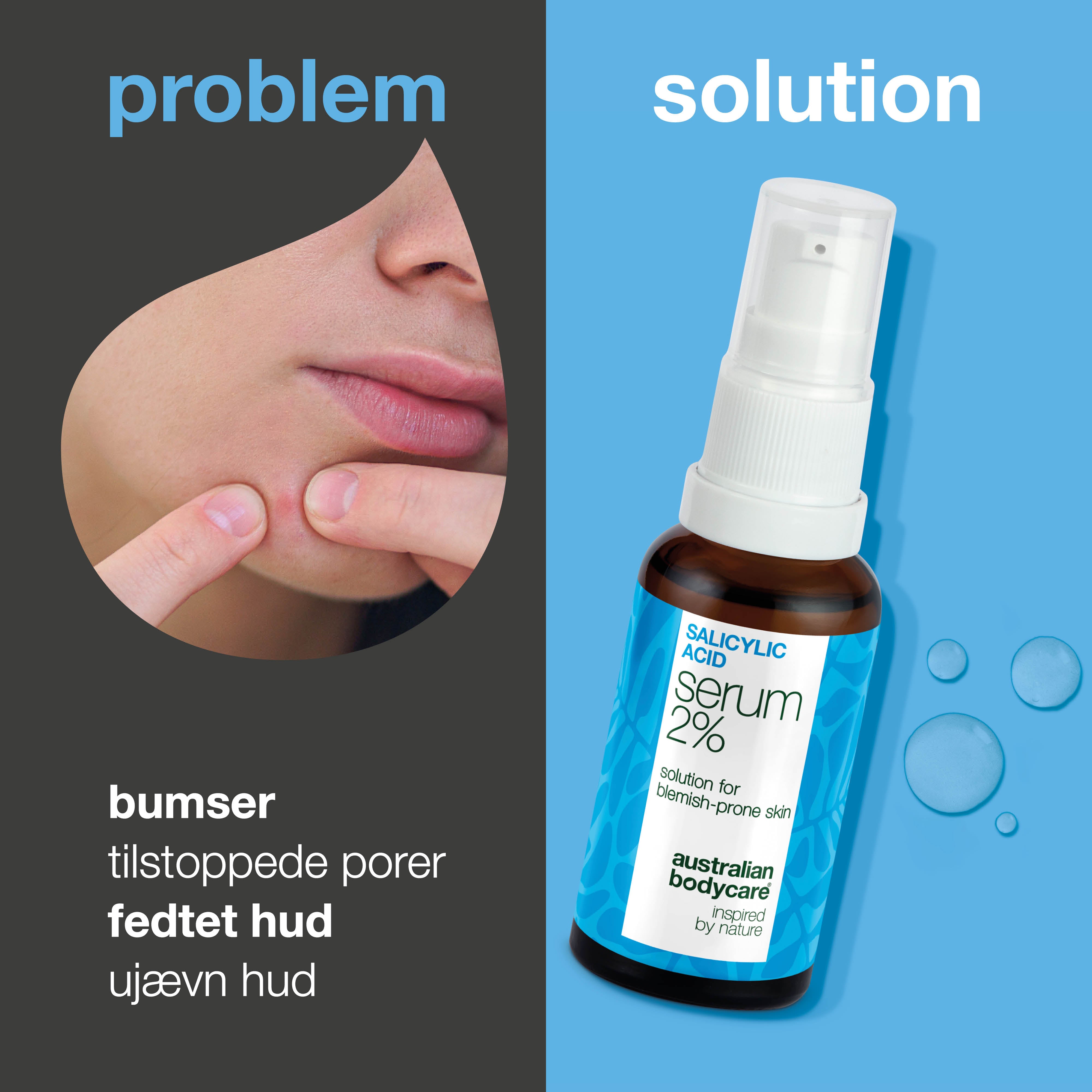 Serum mod bumser, hudorme og uren hud – Salicylsyre 2 % — Serum mod bumser og fedtet hud. Renser porer og dæmper udbrud. Med salicylsyre 2 %, Zinc PCA, grøn te og hyaluronsyre.