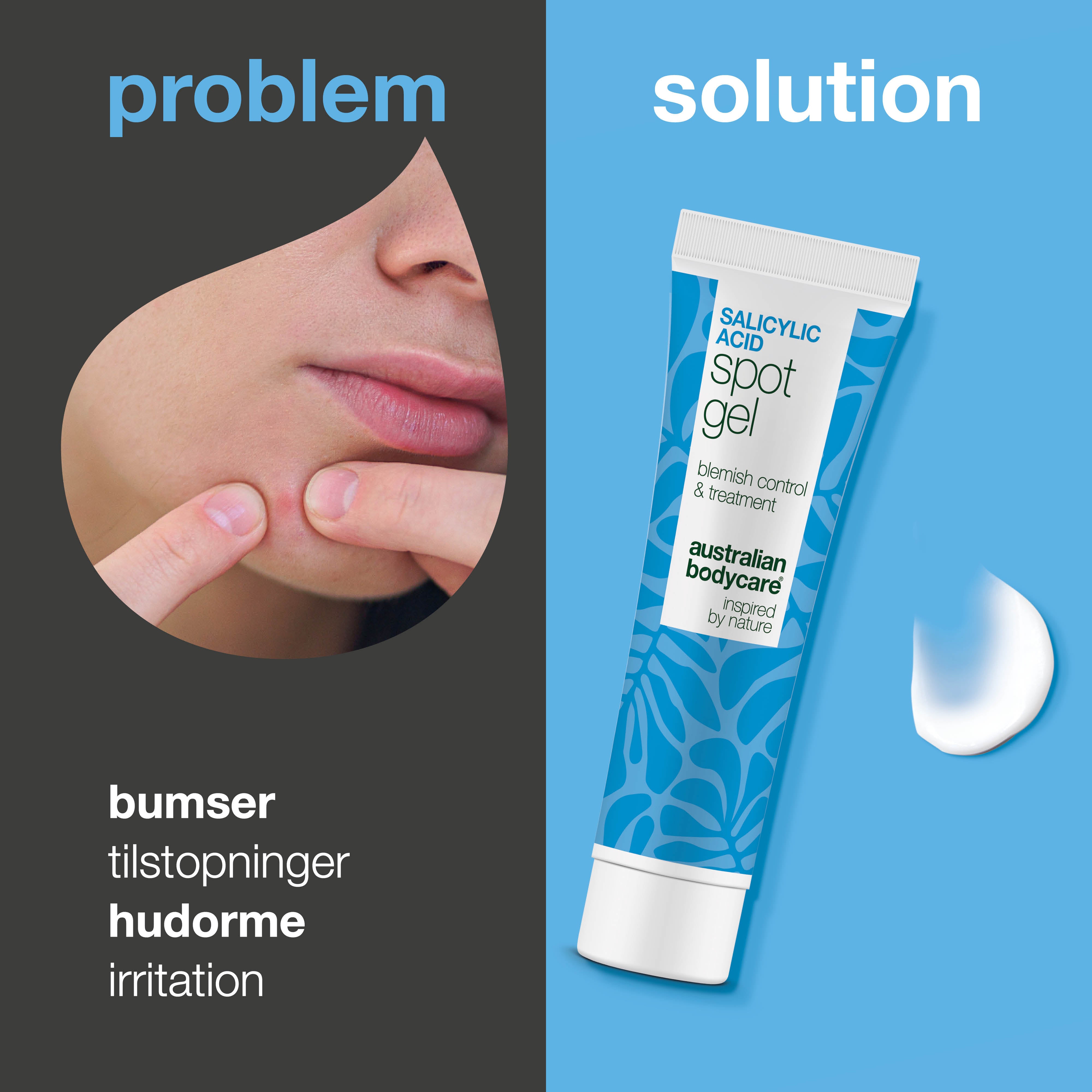 Salicylsyre Spot Gel mod bumser, hudorme og rødme — Salicylsyre Spot Gel til uren hud. Reducerer rødme og tilstopninger med effektiv salicylsyre for en klarere hud.